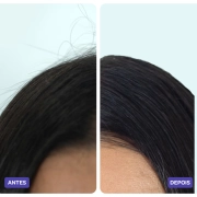 Produto Ampola para Cabelo Xô Frizz 15ml - Forever Liss